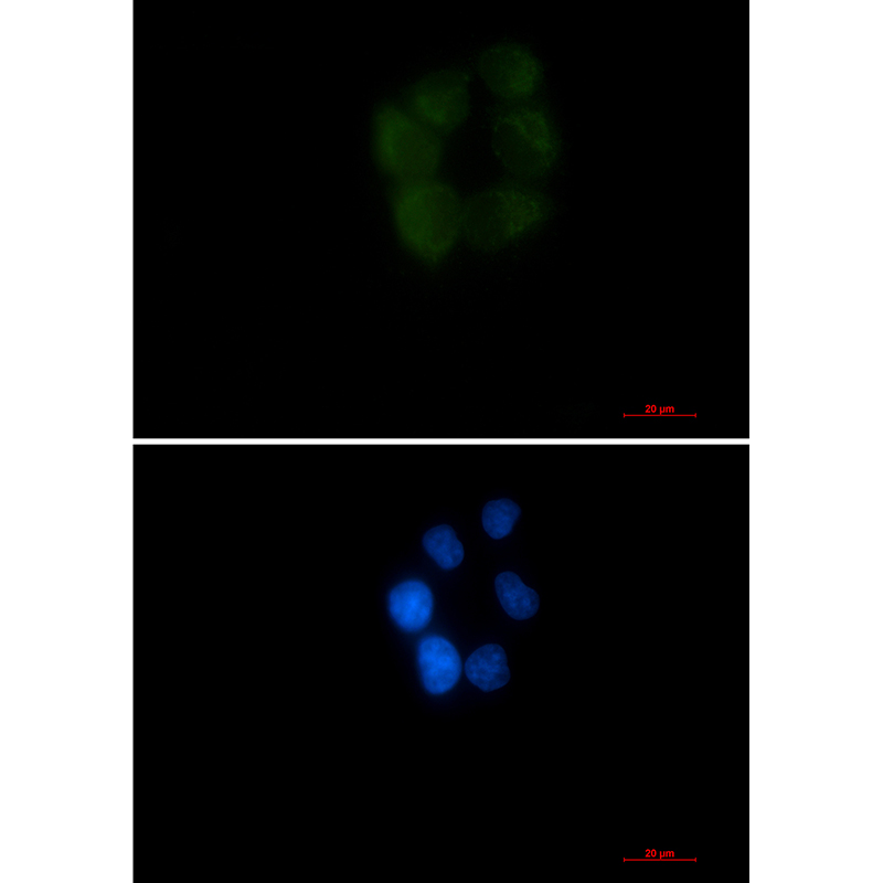 Rabbit Monoclonal Antibody to AK3L1