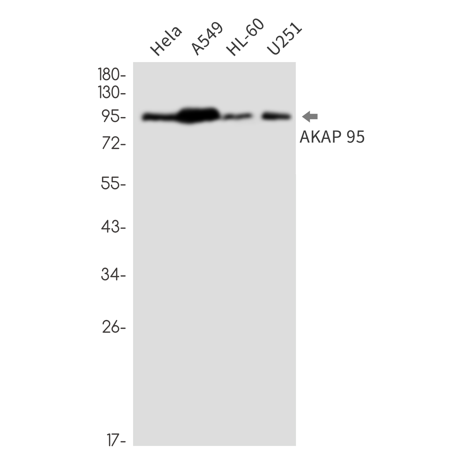 Rabbit Monoclonal Antibody to AKAP95