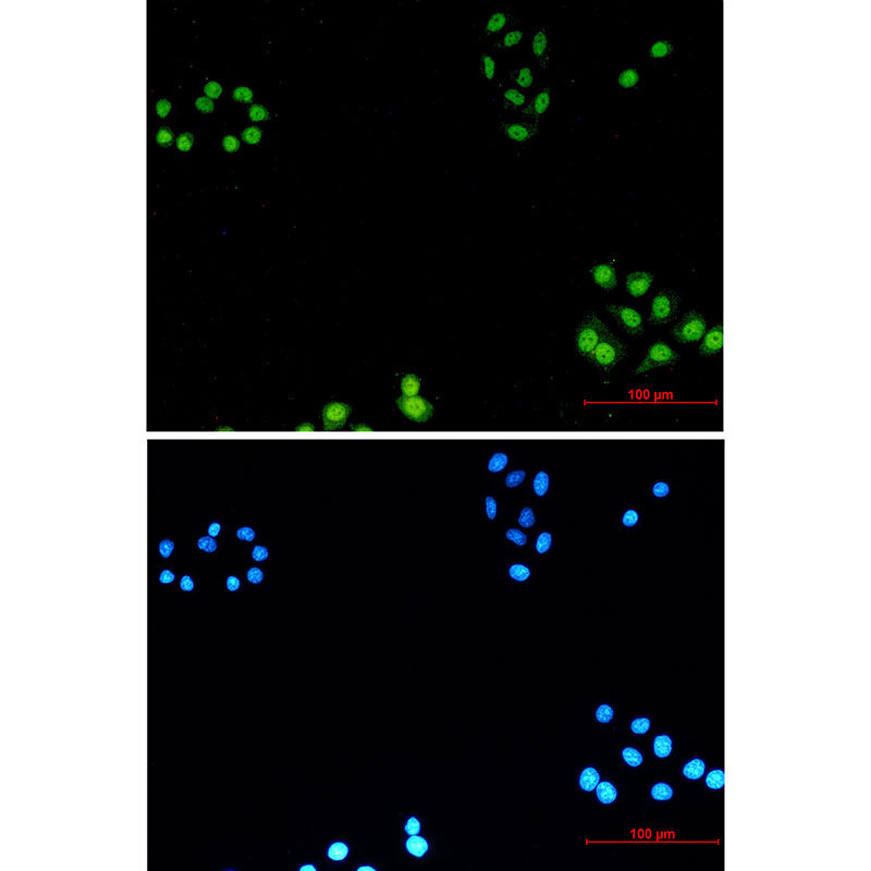 Rabbit Monoclonal Antibody to AKAP95