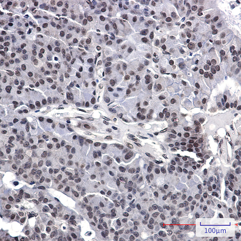 Rabbit Monoclonal Antibody to AKAP95