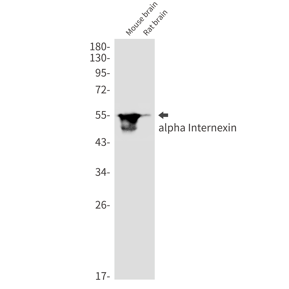 alpha Internexin