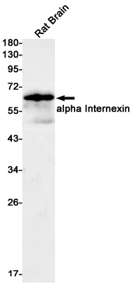 Rabbit Monoclonal Antibody to alpha Internexin