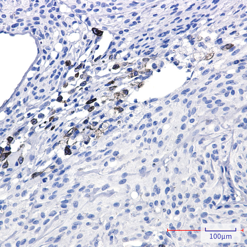Rabbit Monoclonal Antibody to alpha Internexin