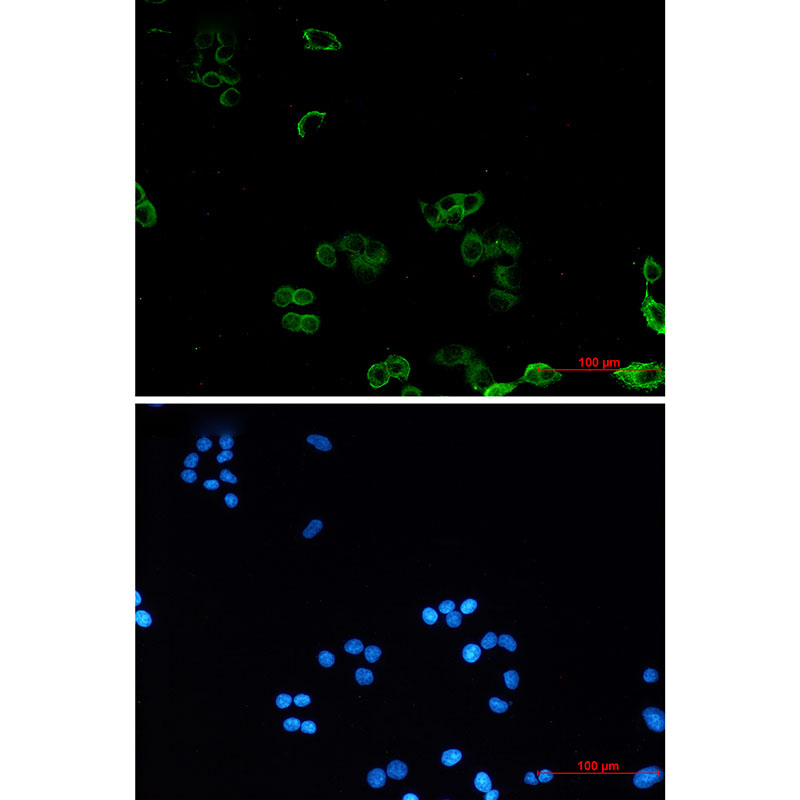 Rabbit Monoclonal Antibody to AMPK gamma 1