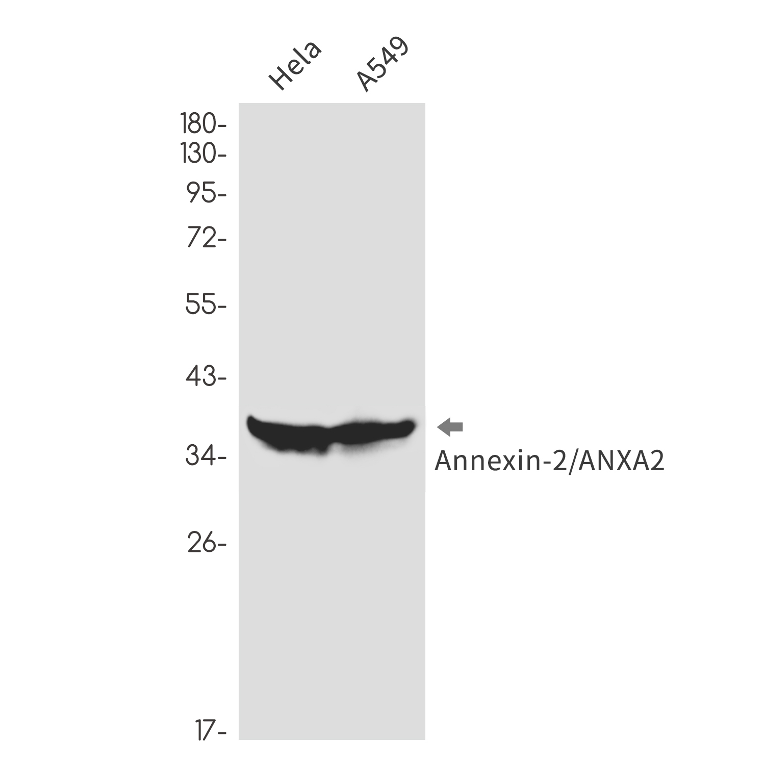 Annexin 2