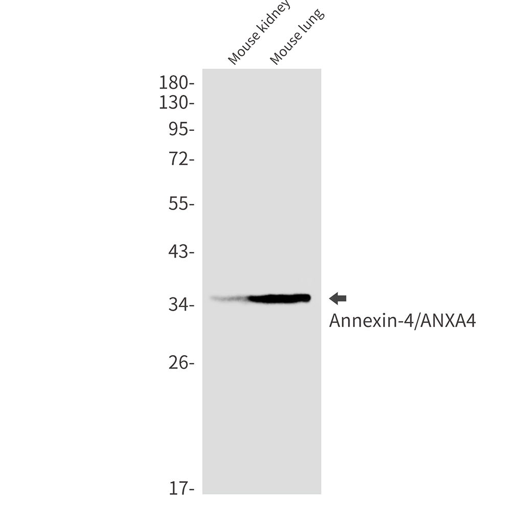 Annexin 4