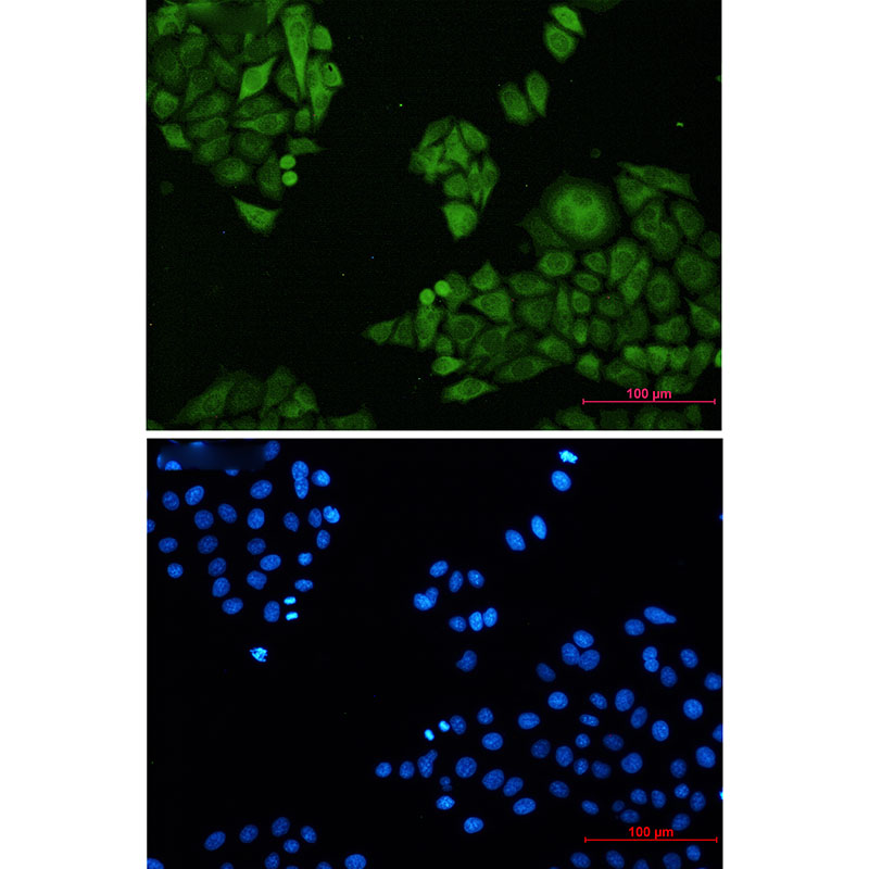 Rabbit Monoclonal Antibody to Annexin 4