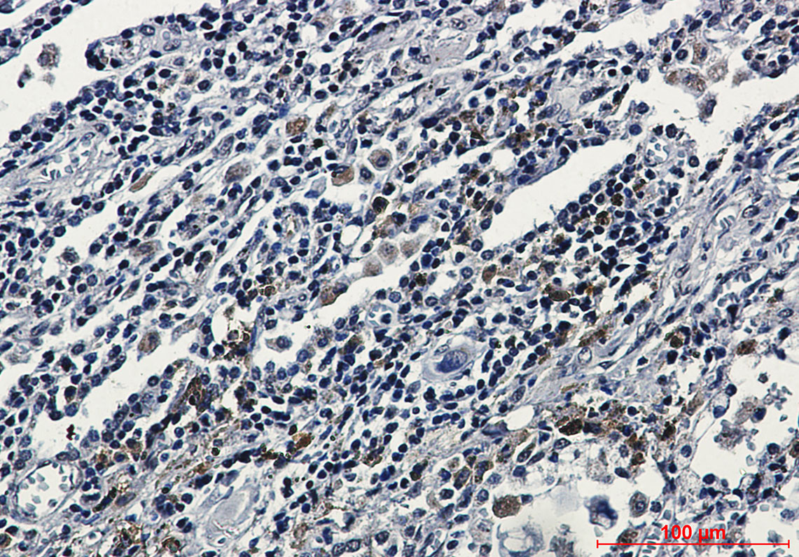 Rabbit Monoclonal Antibody to ATF6