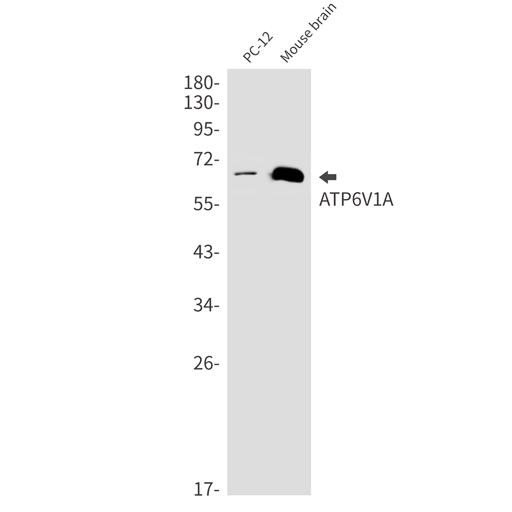 ATP6V1A