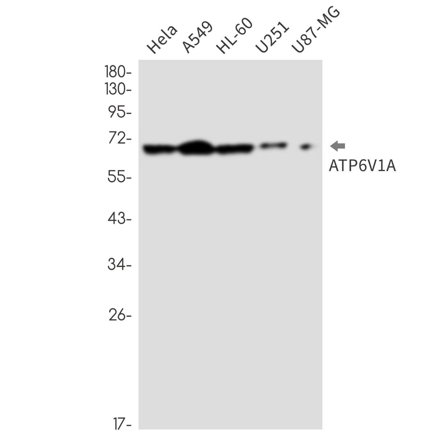 Rabbit Monoclonal Antibody to ATP6V1A