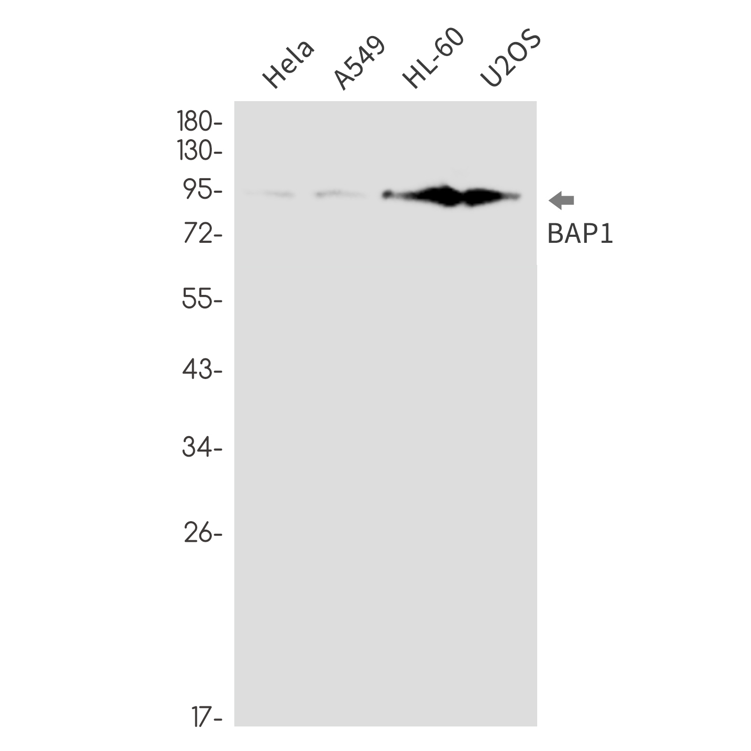BAP1