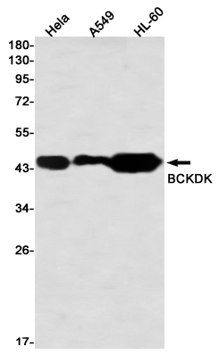 Rabbit Monoclonal Antibody to BCKDK