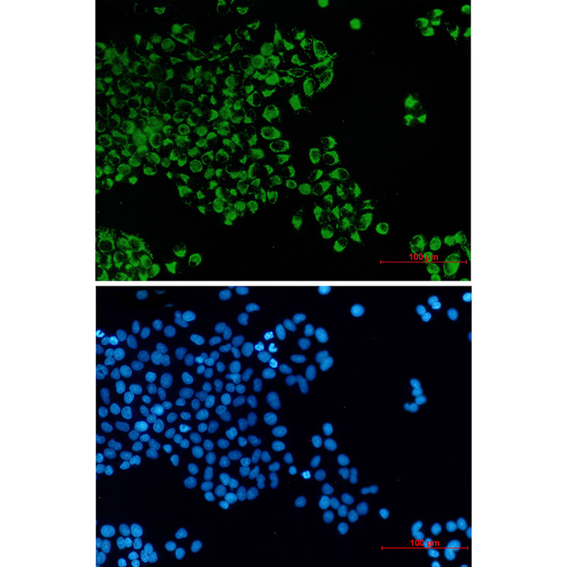 Rabbit Monoclonal Antibody to Bcl2 L14