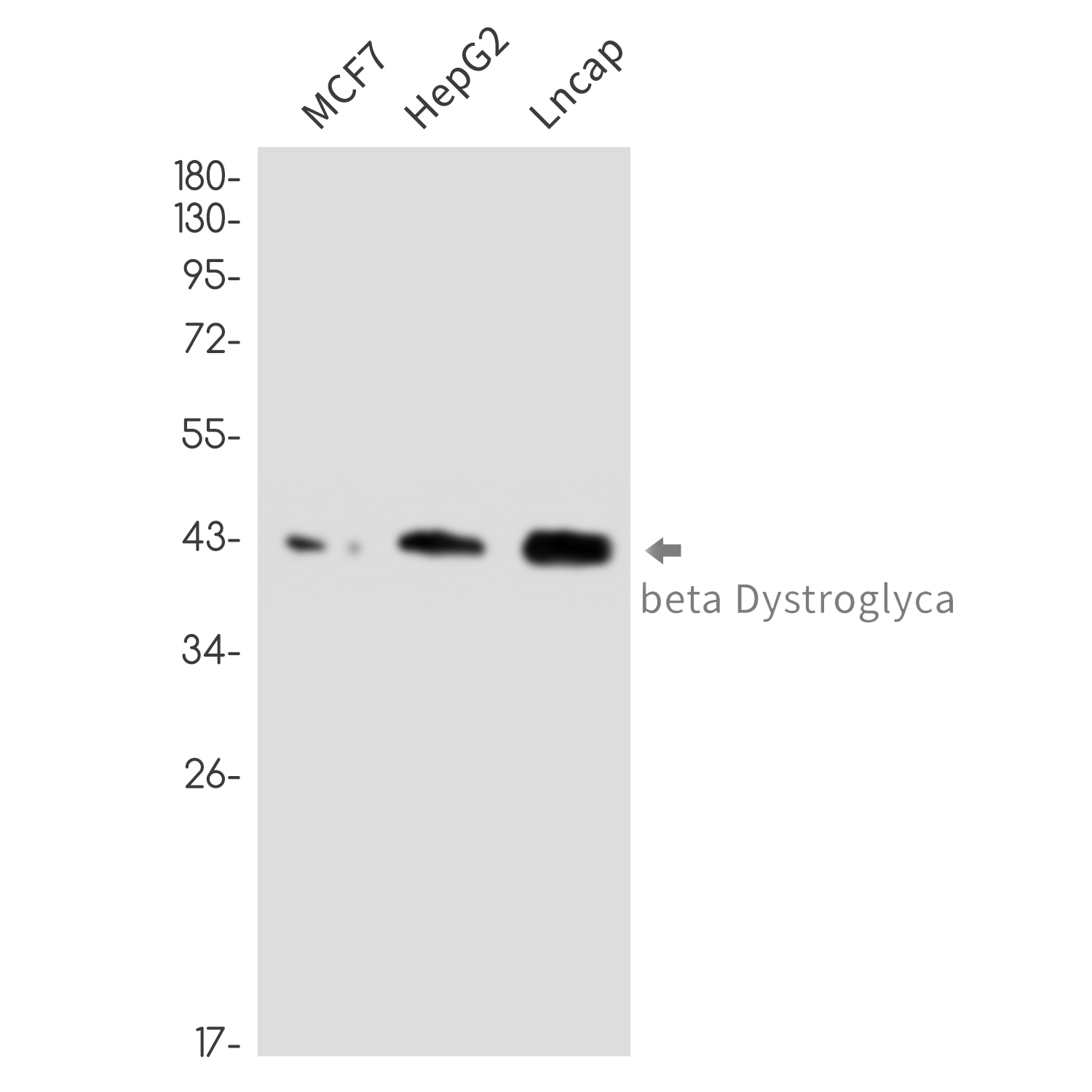beta Dystroglycan