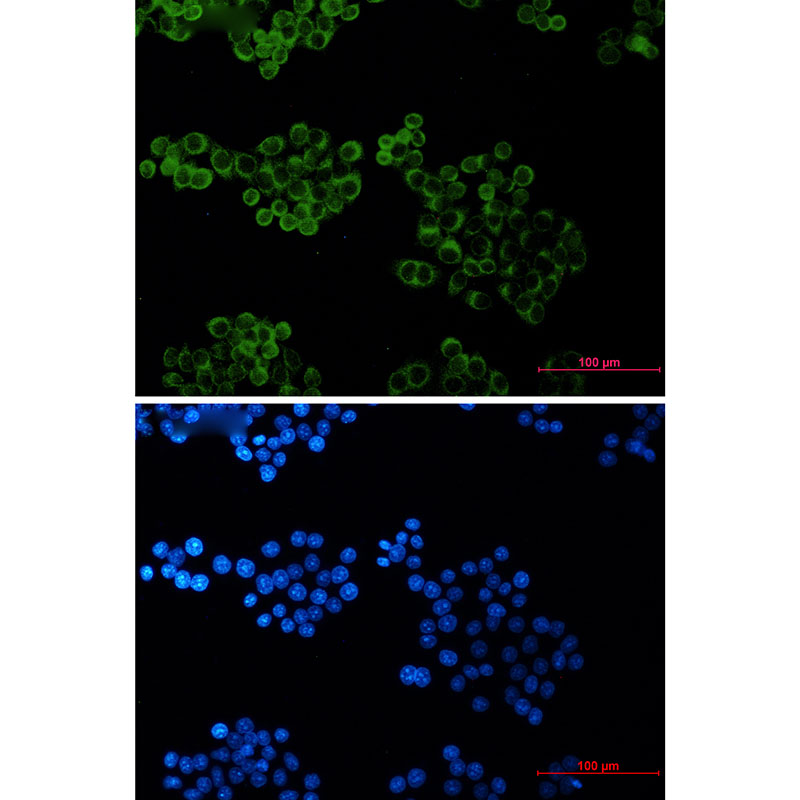 Rabbit Monoclonal Antibody to Bid
