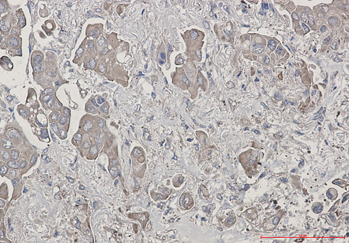 Rabbit Monoclonal Antibody to Bid