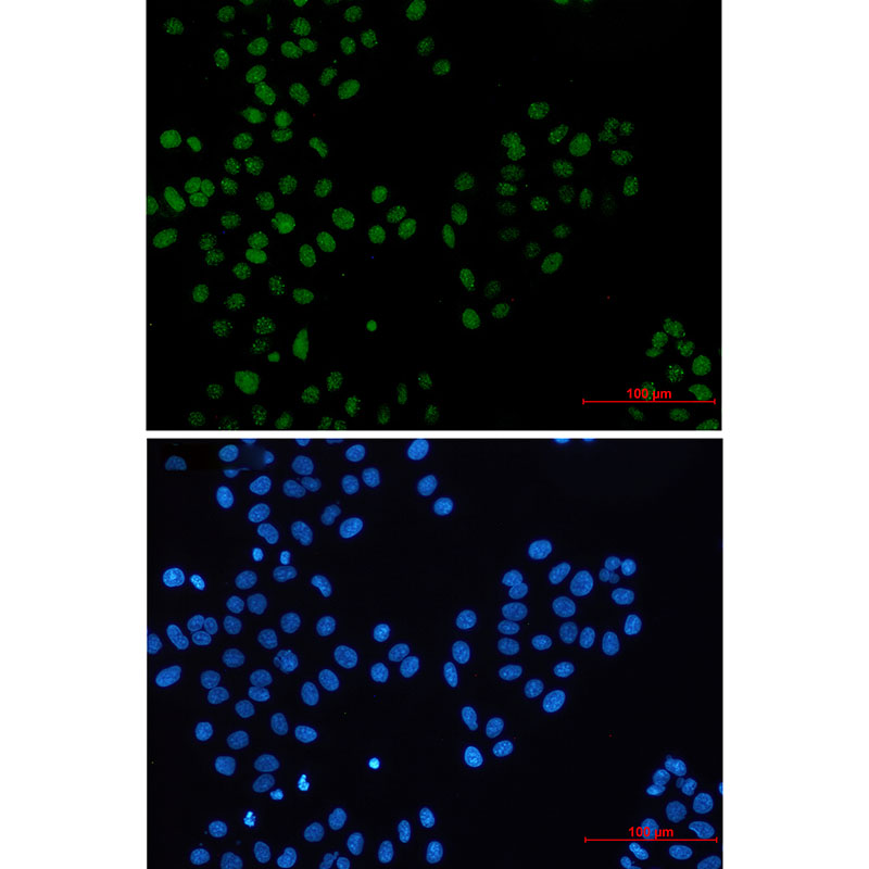 Rabbit Monoclonal Antibody to BMI1