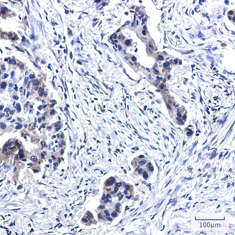 Rabbit Monoclonal Antibody to BUBR1