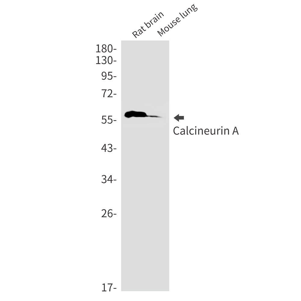 Calcineurin A