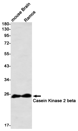 Rabbit Monoclonal Antibody to Casein Kinase 2 beta