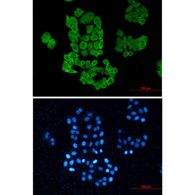 Rabbit Monoclonal Antibody to CCT2