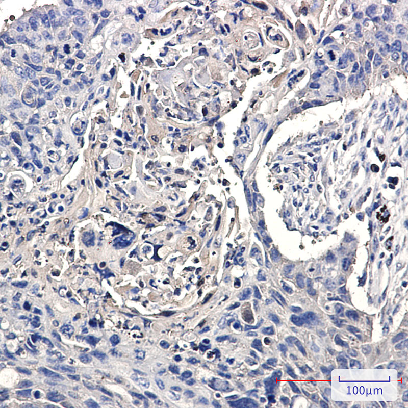 Rabbit Monoclonal Antibody to CCT2