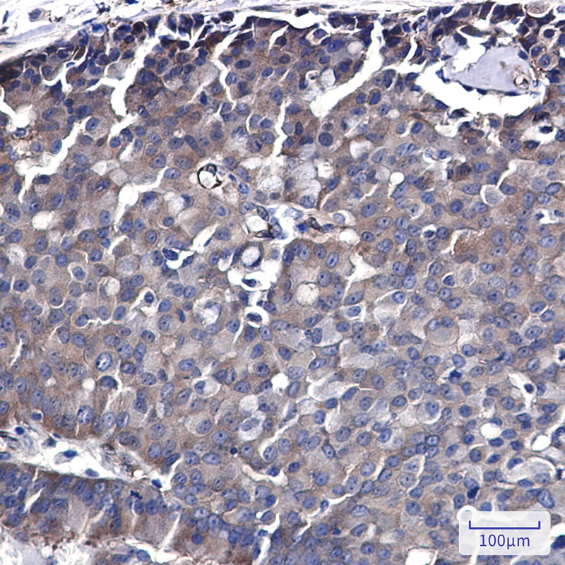 Rabbit Monoclonal Antibody to CDC37