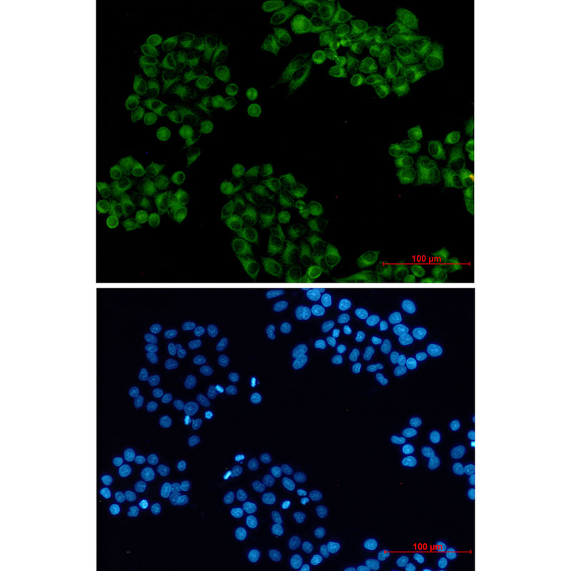 Rabbit Monoclonal Antibody to Cellubrevin