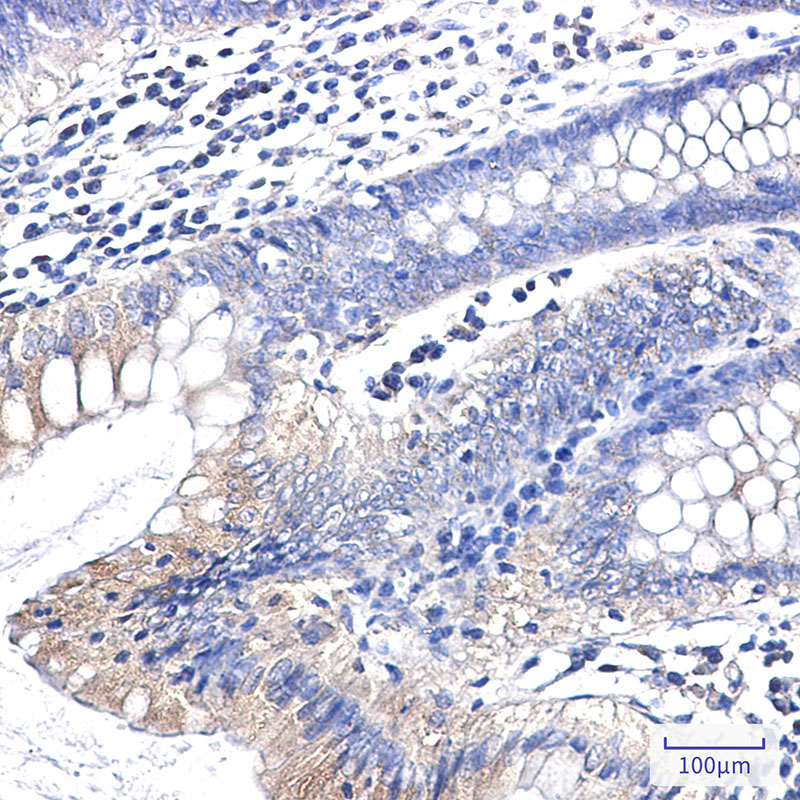 Rabbit Monoclonal Antibody to Clathrin Heavy Chain