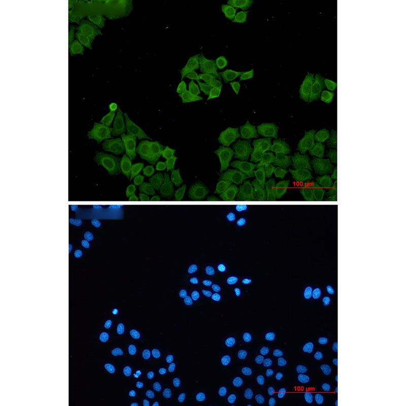 Rabbit Monoclonal Antibody to CLIC1
