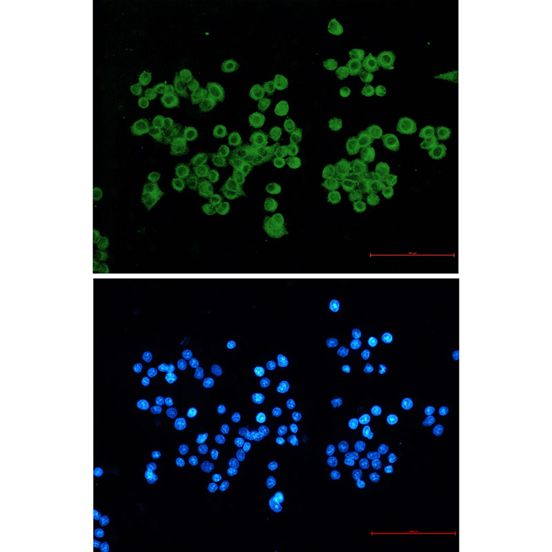 Rabbit Monoclonal Antibody to CLIP170