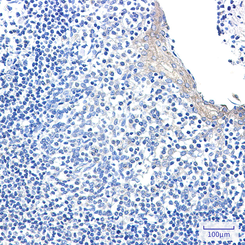 Rabbit Monoclonal Antibody to CLIP170