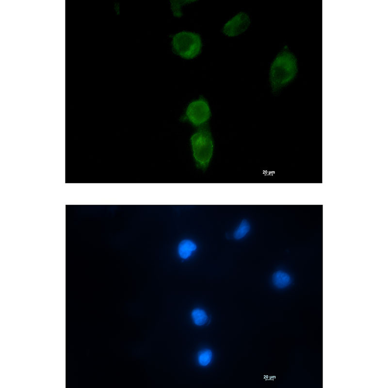 Rabbit Monoclonal Antibody to CLPX