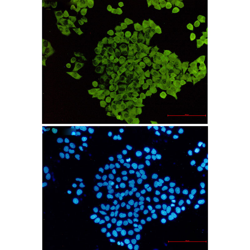 Rabbit Monoclonal Antibody to Cofilin