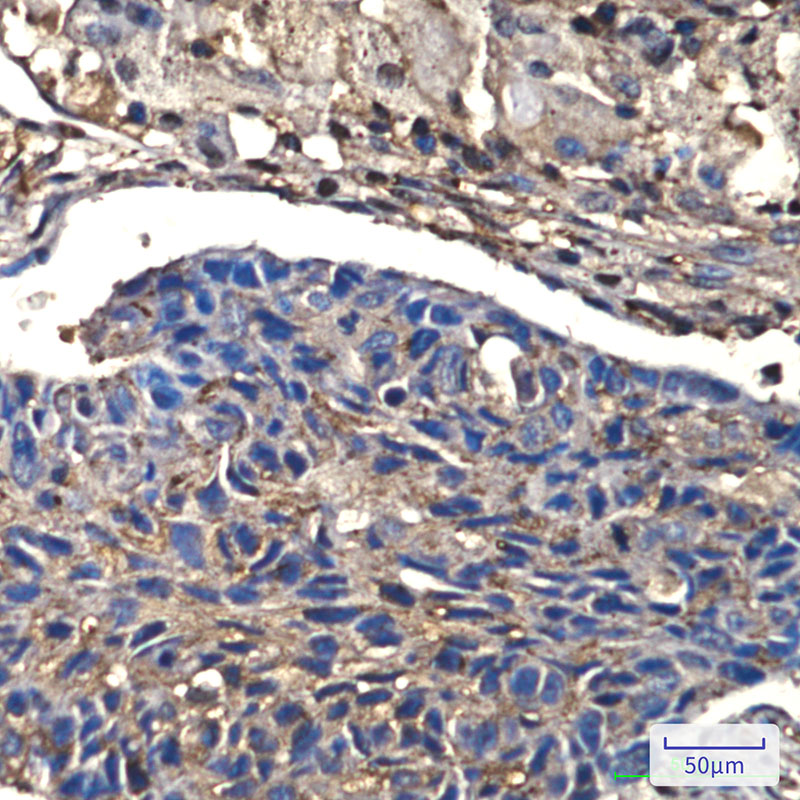 Rabbit Monoclonal Antibody to Cofilin