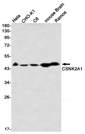 CSNK2A1