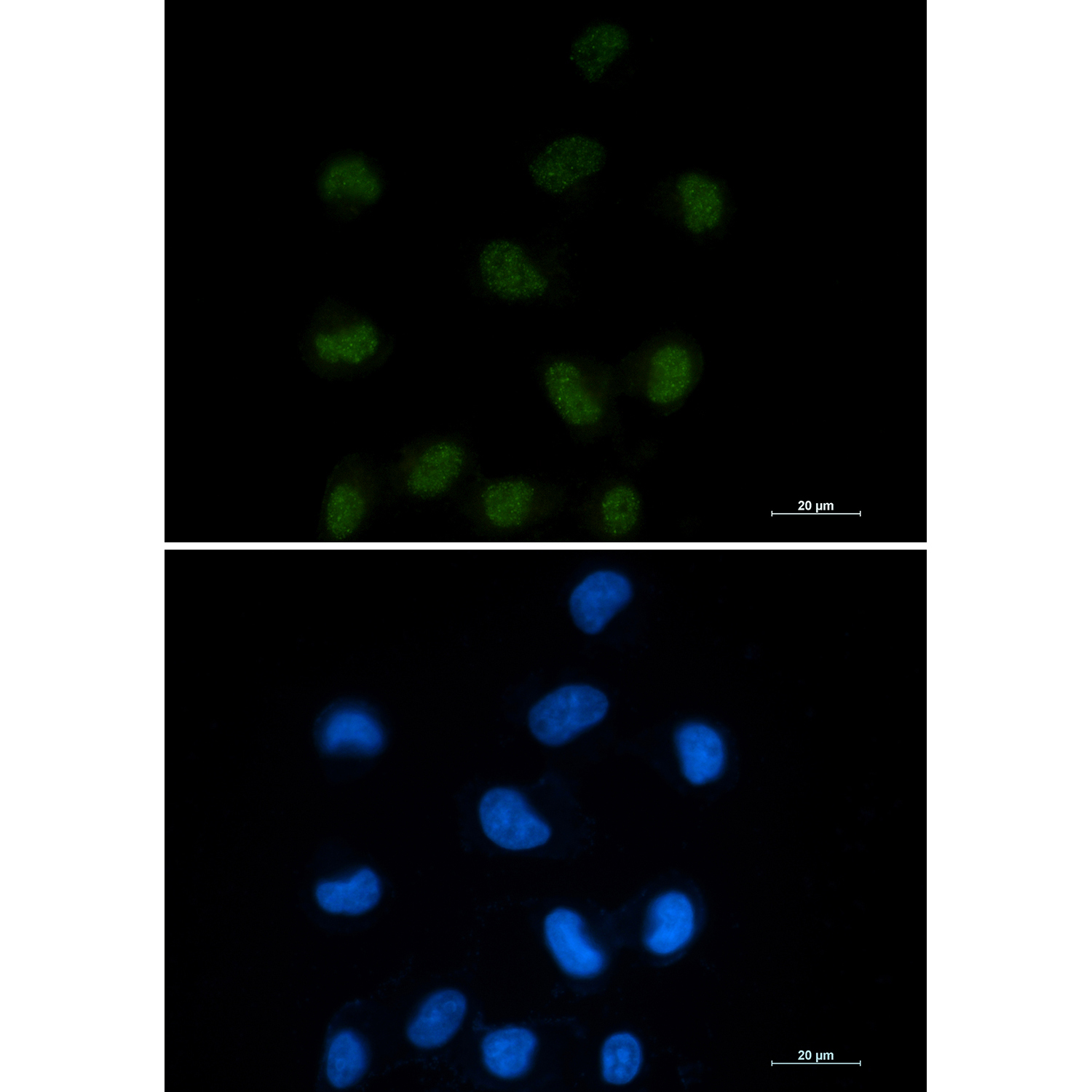 Rabbit Monoclonal Antibody to CTBP1
