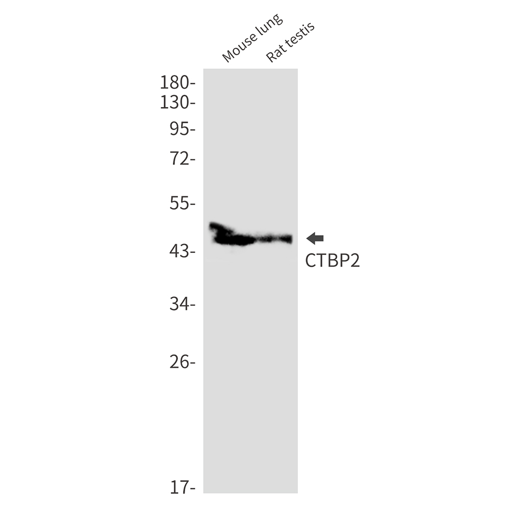 CTBP2