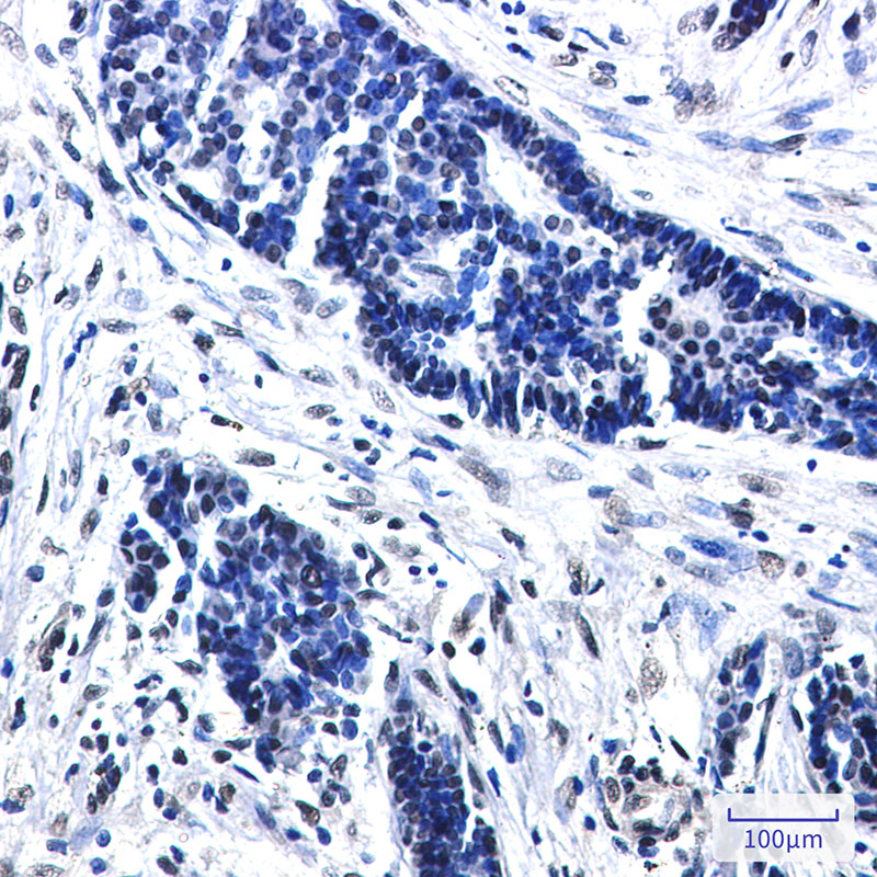 Rabbit Monoclonal Antibody to CTBP2
