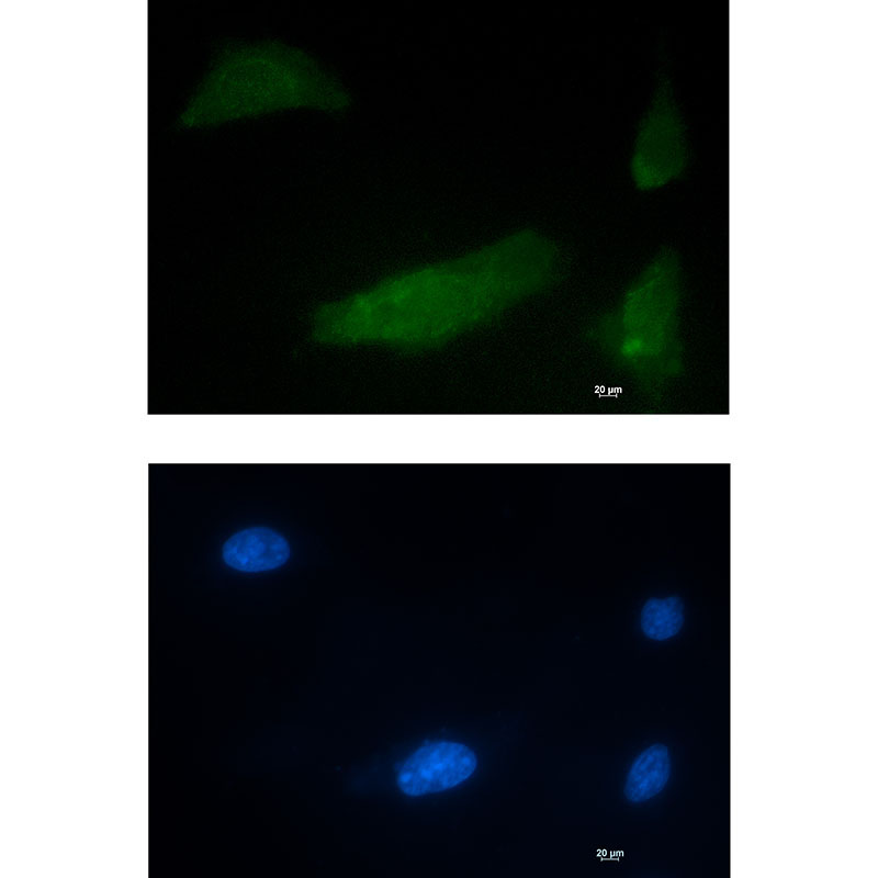 Rabbit Monoclonal Antibody to CUG BP1