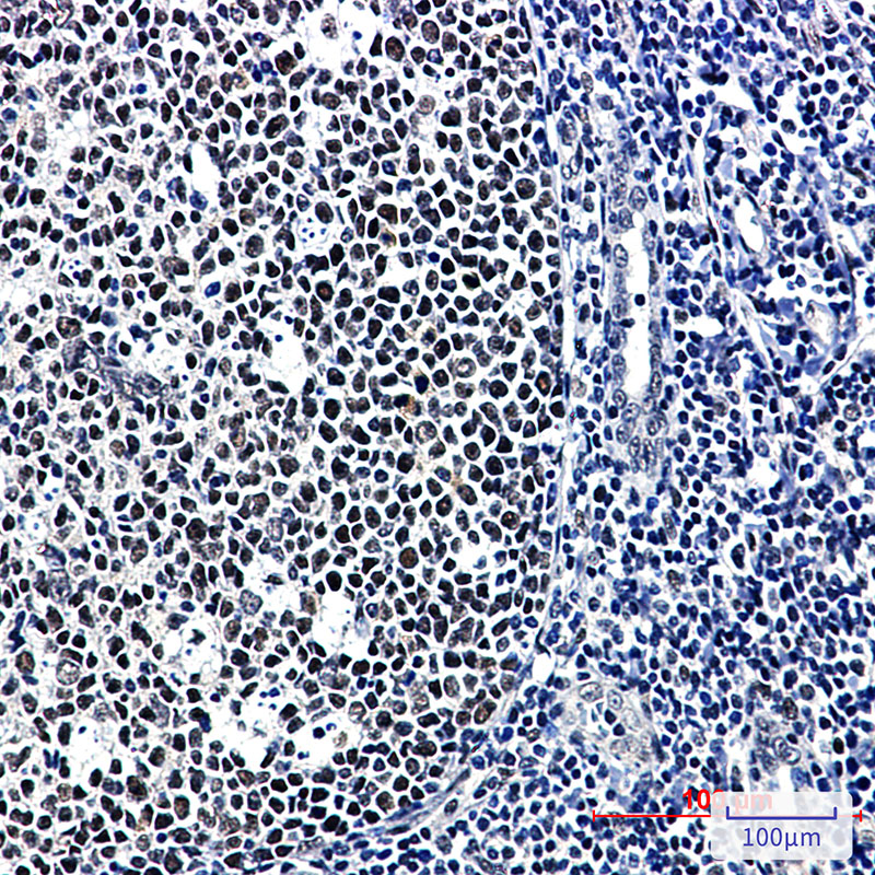 Rabbit Monoclonal Antibody to CUG BP1