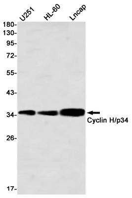 Rabbit Monoclonal Antibody to Cyclin H