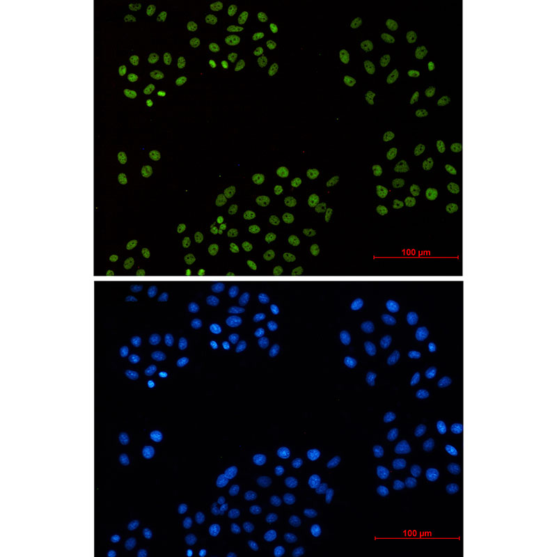 Rabbit Monoclonal Antibody to Cyclin H