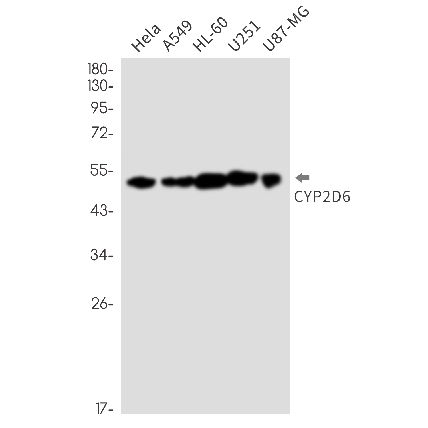 Cytochrome P450 2D6