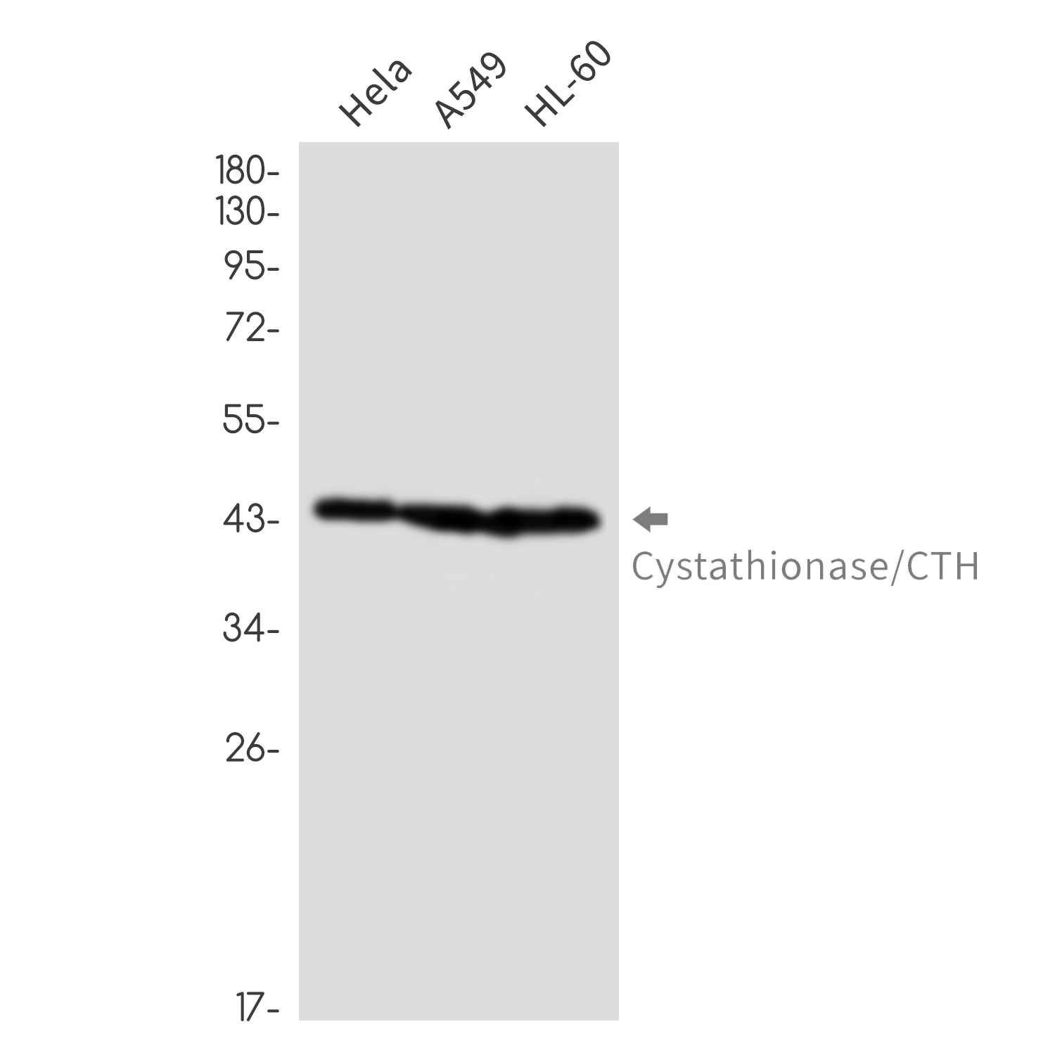 Cystathionase