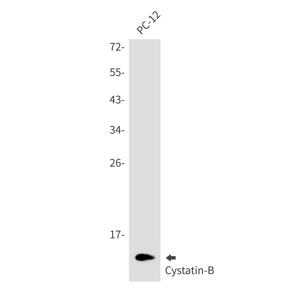 Cystatin B