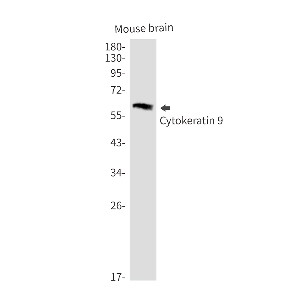Cytokeratin 9
