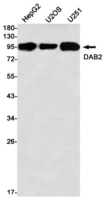 DAB2