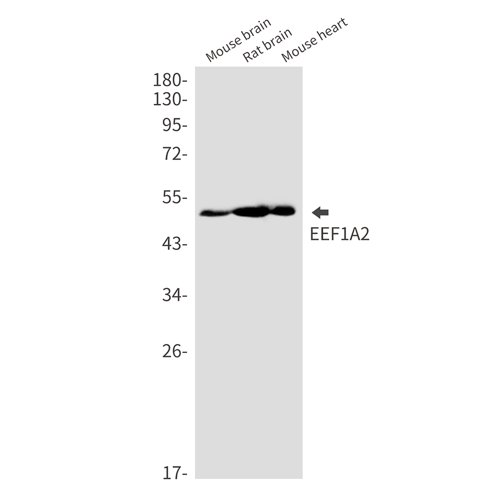 Elongation Factor 1A2