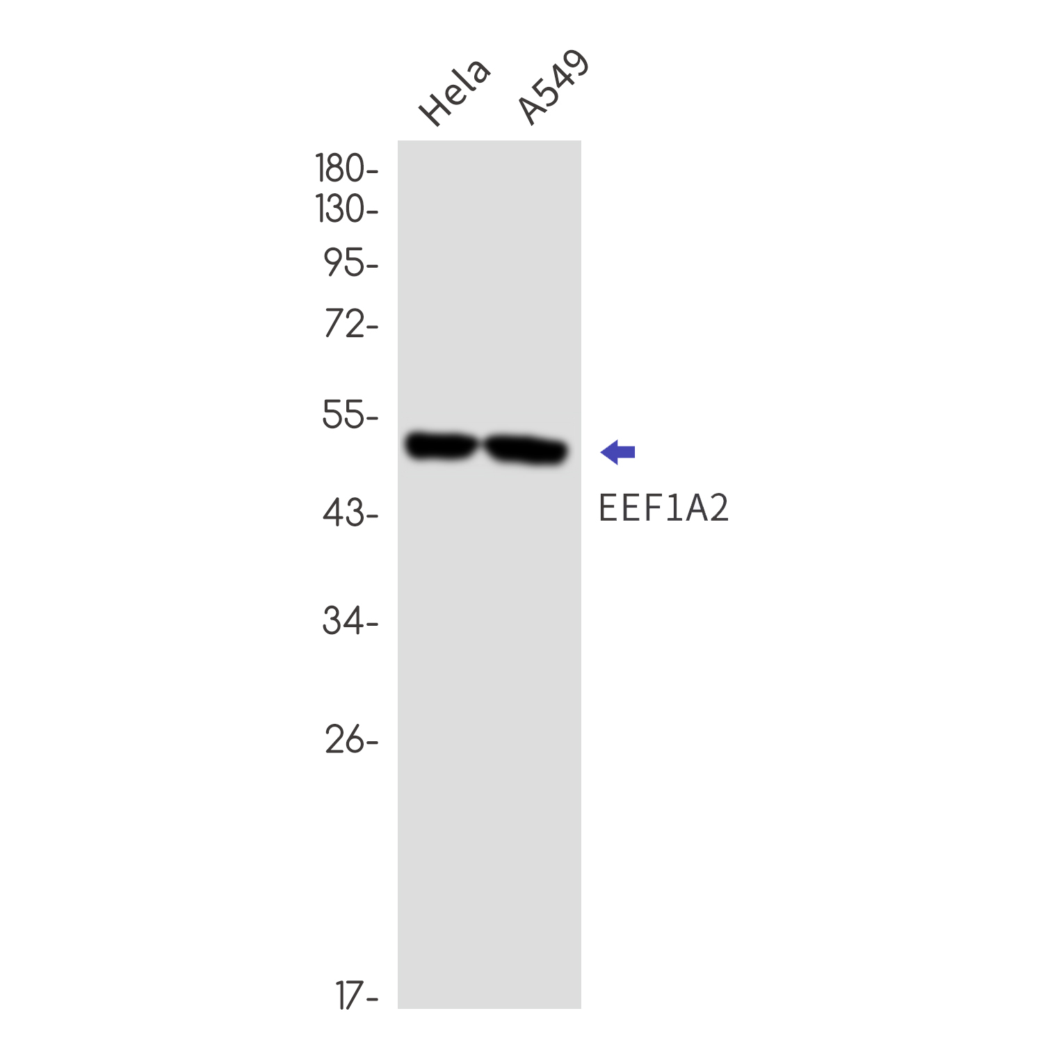 Rabbit Monoclonal Antibody to Elongation Factor 1A2